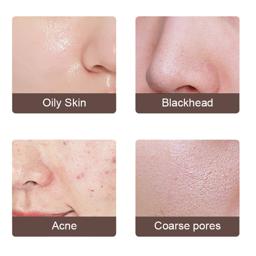 Electric Ultrasonic Face Skin Scrubber
