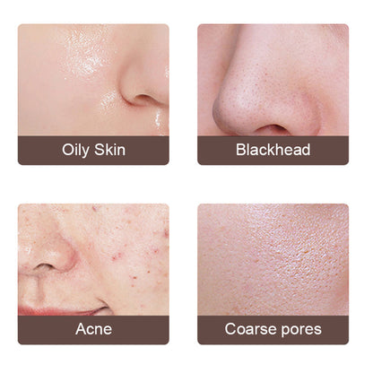 Electric Ultrasonic Face Skin Scrubber